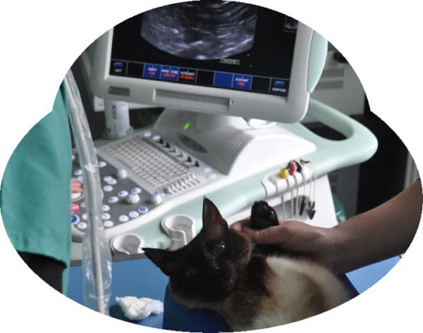 Échographie